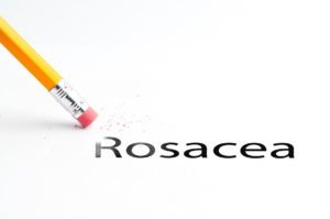 Home Care in Glenwood MN: Four Important Things You Should Know About Rosacea
