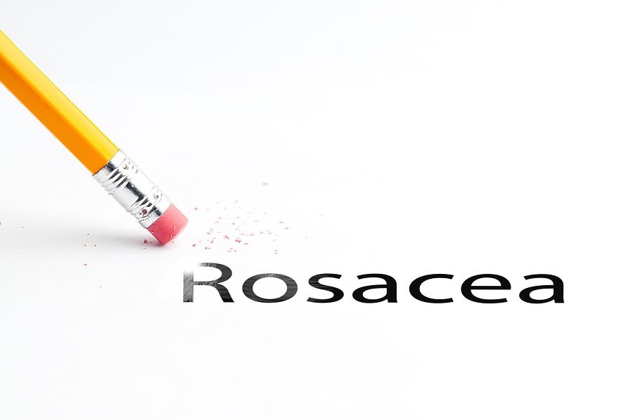 Home Care in Glenwood MN: Four Important Things You Should Know About Rosacea