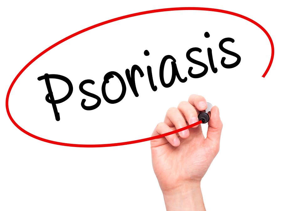 Elderly Care in Belgrade MN: 6 Ways to Keep Psoriasis at Bay